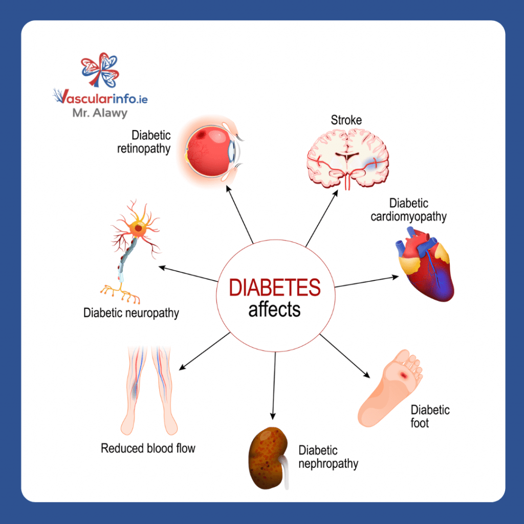 Diabetic Foot - Vascular Info