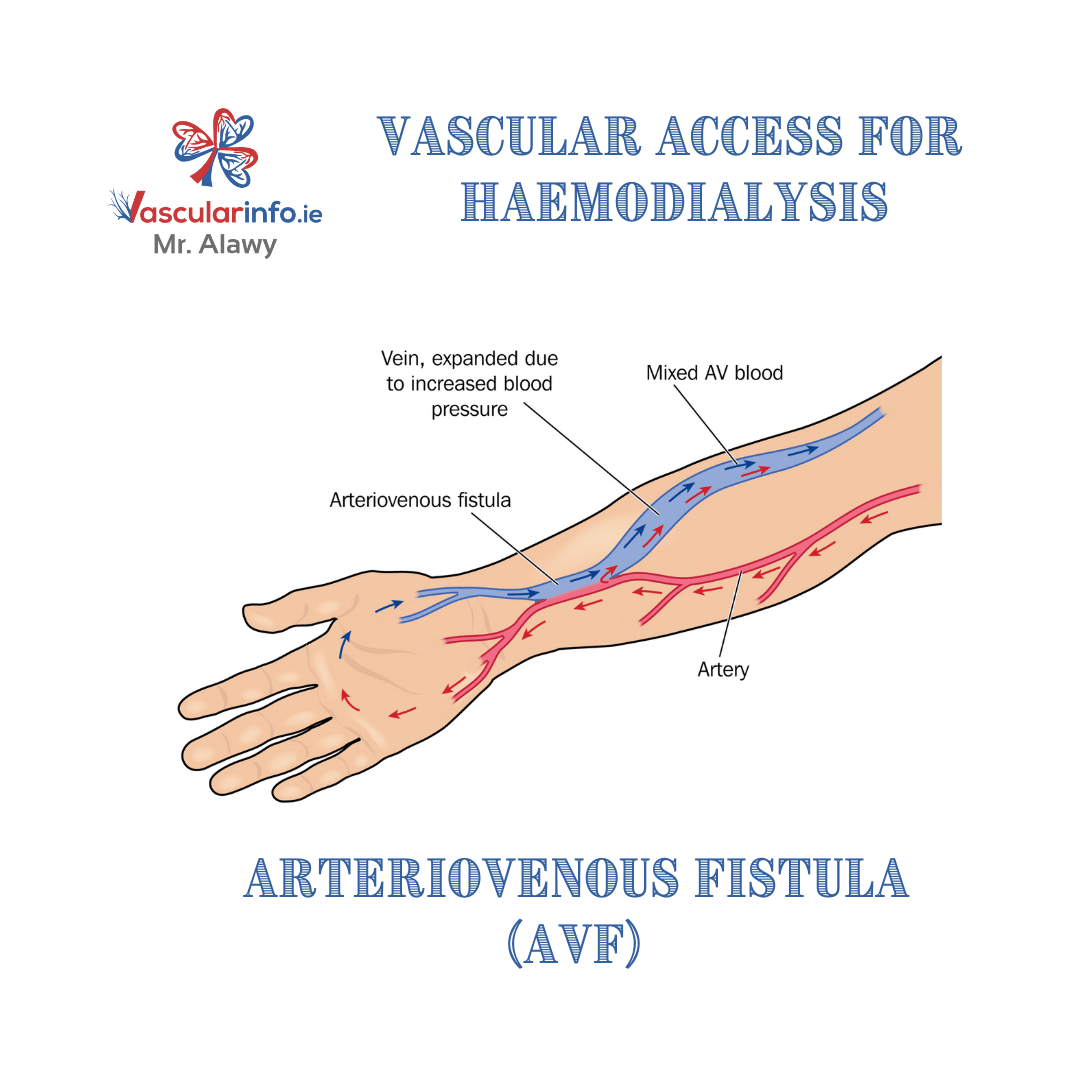 Treatments - Vascular Info